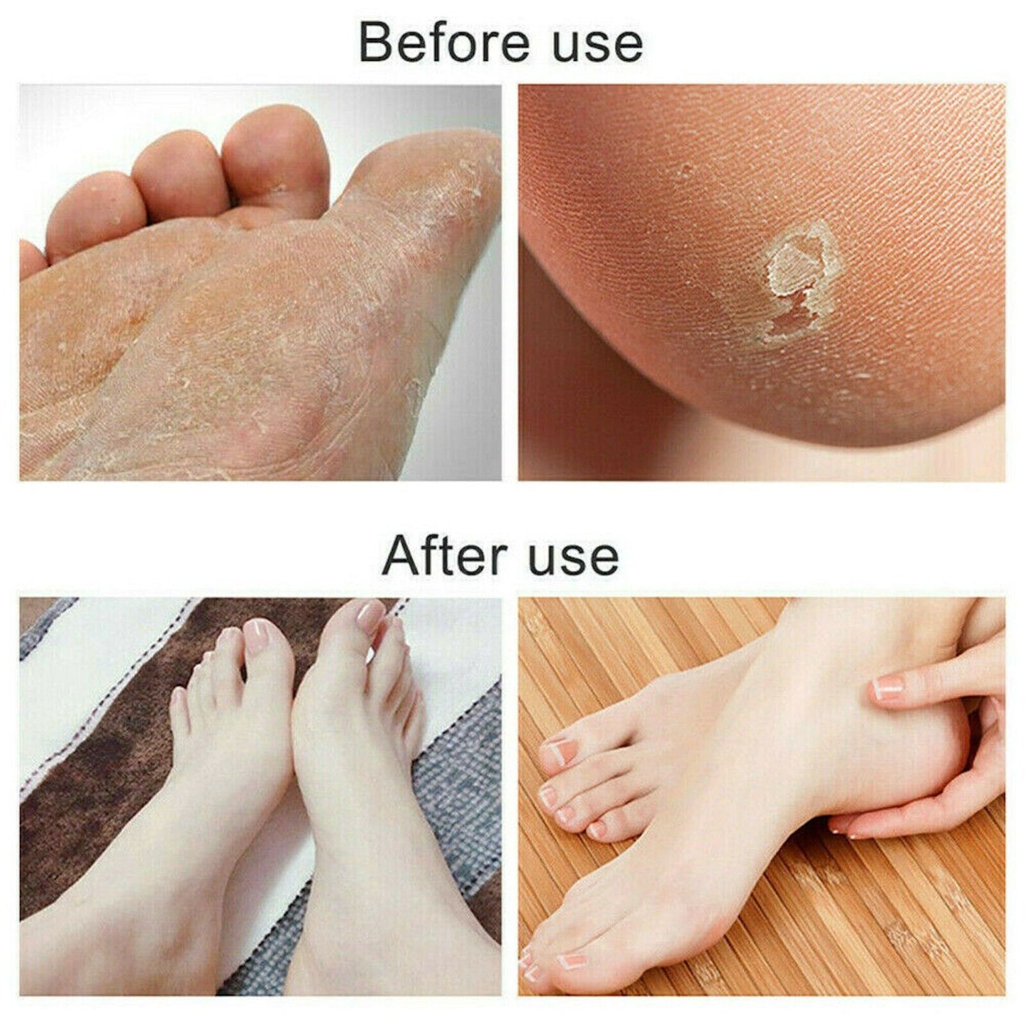 Foot File Scraper Rasp Hard Dead Dry Skin Remover Grater Callus Pedicure Black