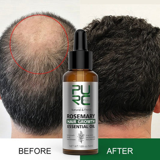 PURC Rosemary Hair Care Essential Oil Ginger Head