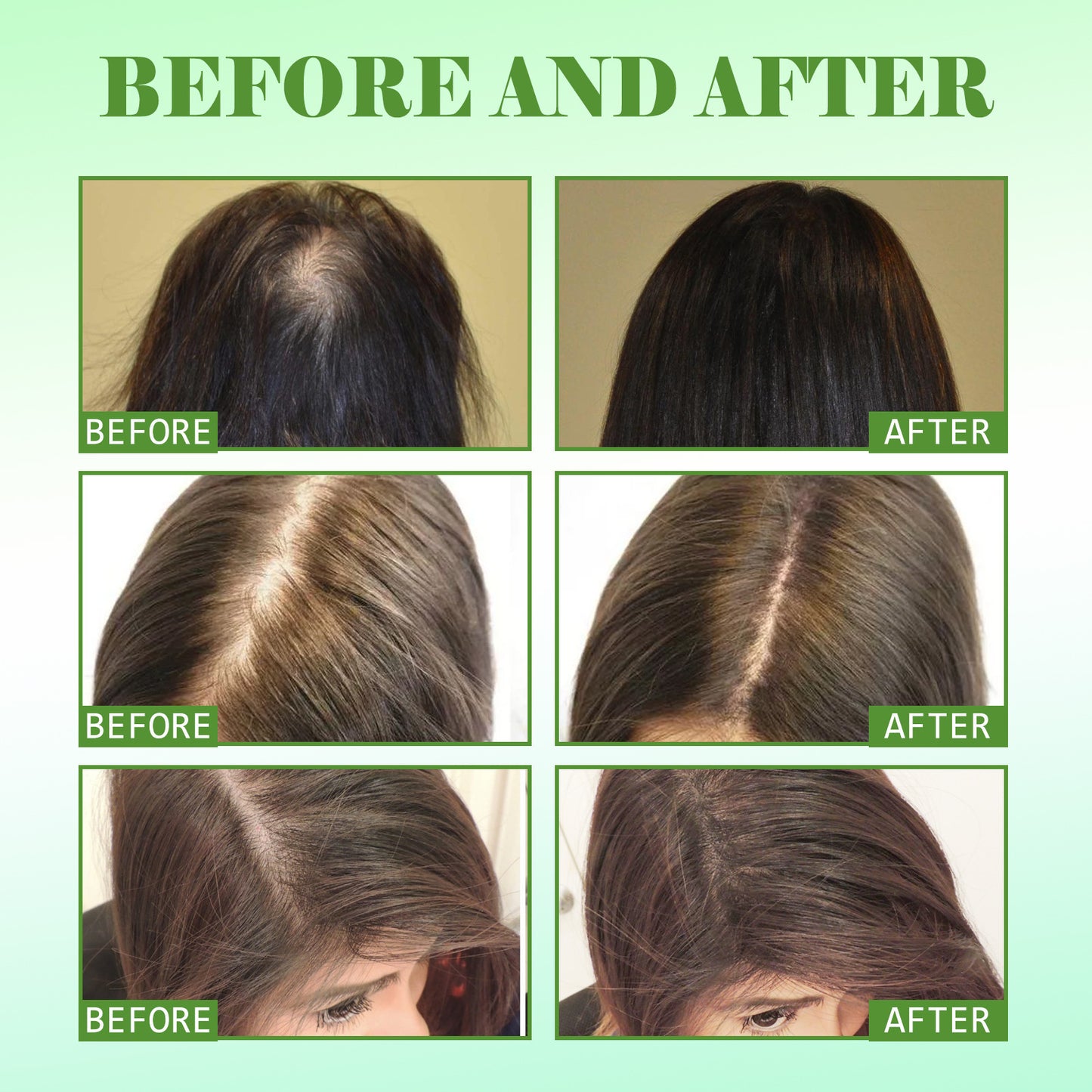 Rosemary Hair Care Essential Oil Repair Damage