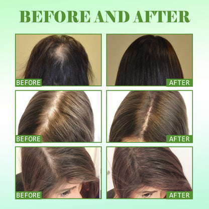 Rosemary Hair Care Essential Oil Repair Damage