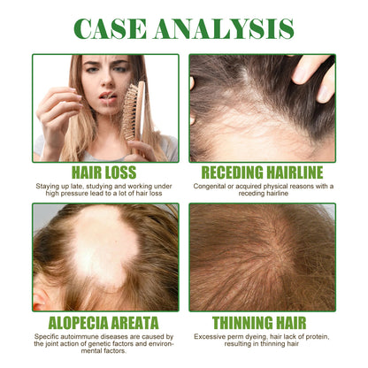 Rosemary Hair Care Essential Oil Repair Damage