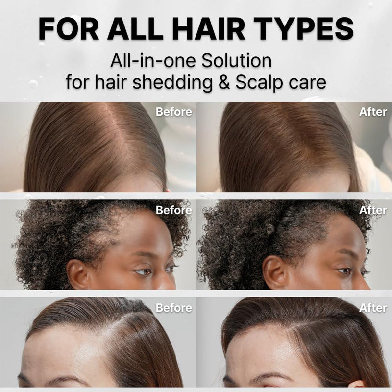 Built-in Brush Head For Massage And To Enhance Hair Density