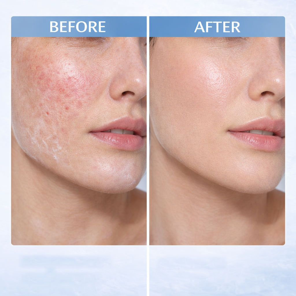 Hyaluronic Acid Hydrating Protective Lotion