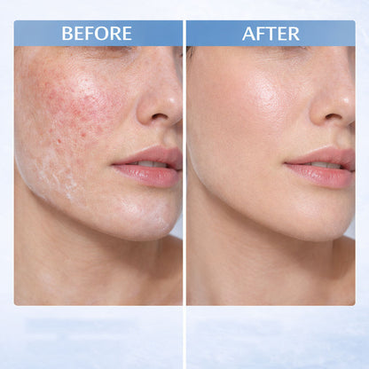 Hyaluronic Acid Hydrating Protective Lotion